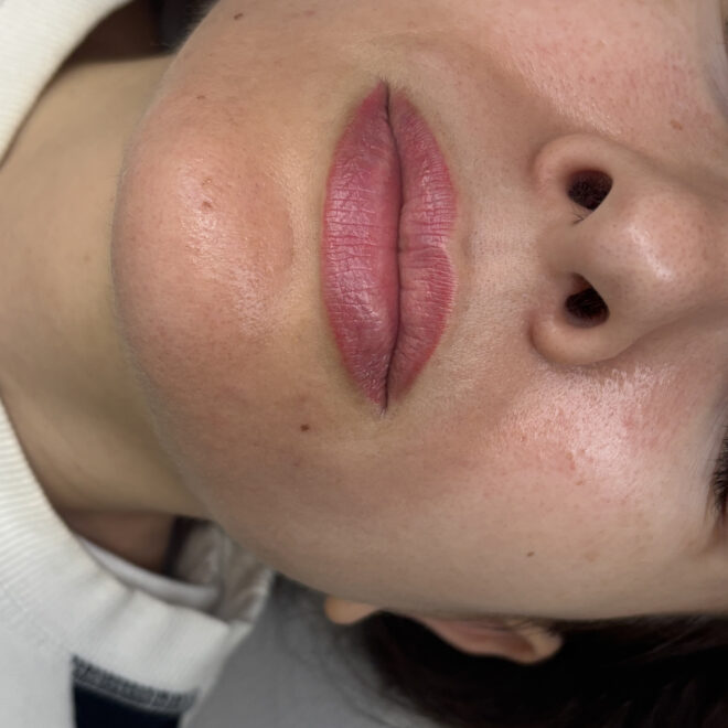 Neutralizacionyomberelips