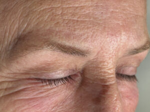 anteshairstrokes antes hairstrokes